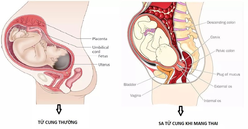 bi-sa-tu-cung-co-mang-thai-duoc-khong-2