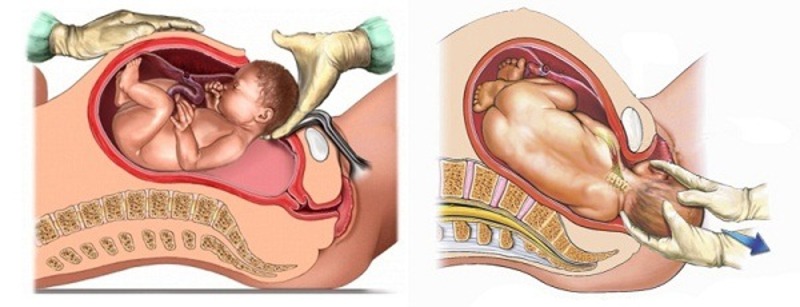 bieu-hien-chuyen-da-khi-sinh​-1