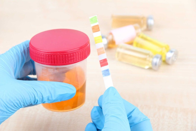 cac-chi-so-xet-nghiem-nuoc-tieu-cua-ba-bau​-3