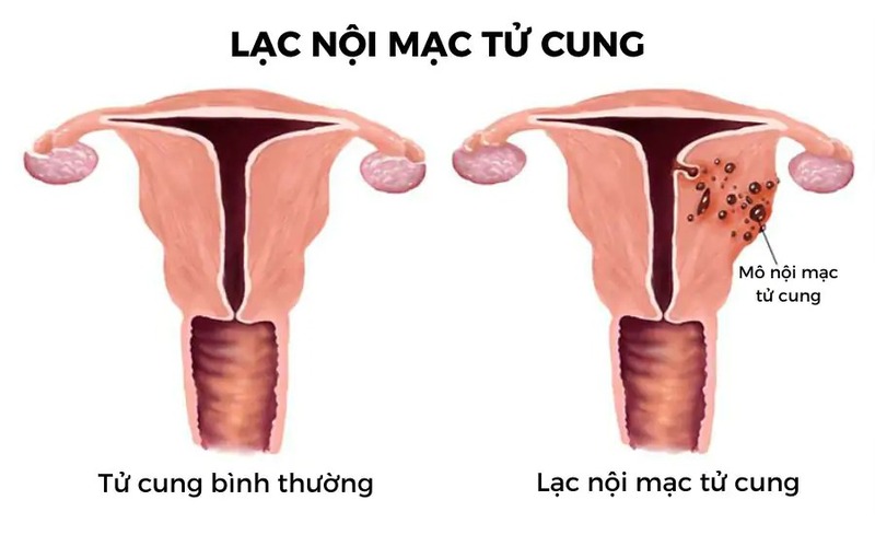 nguyen-nhan-kho-thu-thai-o-phu-nu​-4