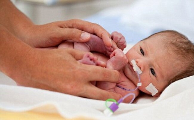 Nguyên nhân sinh non mà mẹ cần biết để ngăn ngừa rủi ro