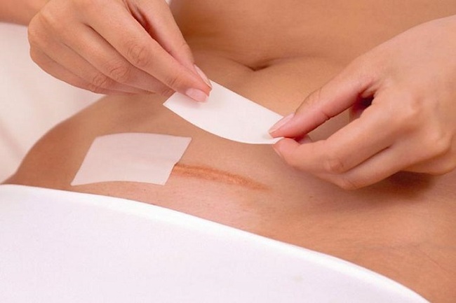 Thời gian để tắm tránh nhiễm trùng khi sinh mổ là bao lâu