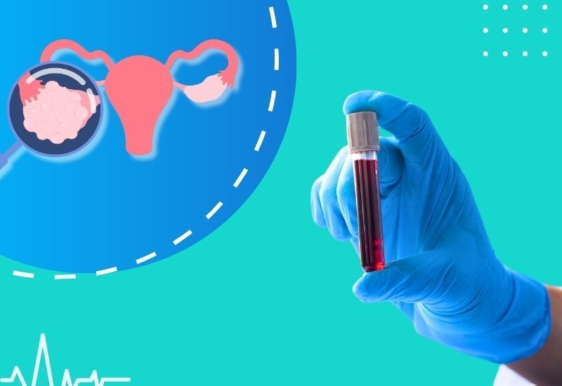 xet-nghiem-ca-125-ung-thu-buong-trung-tai-bamboo-care-2